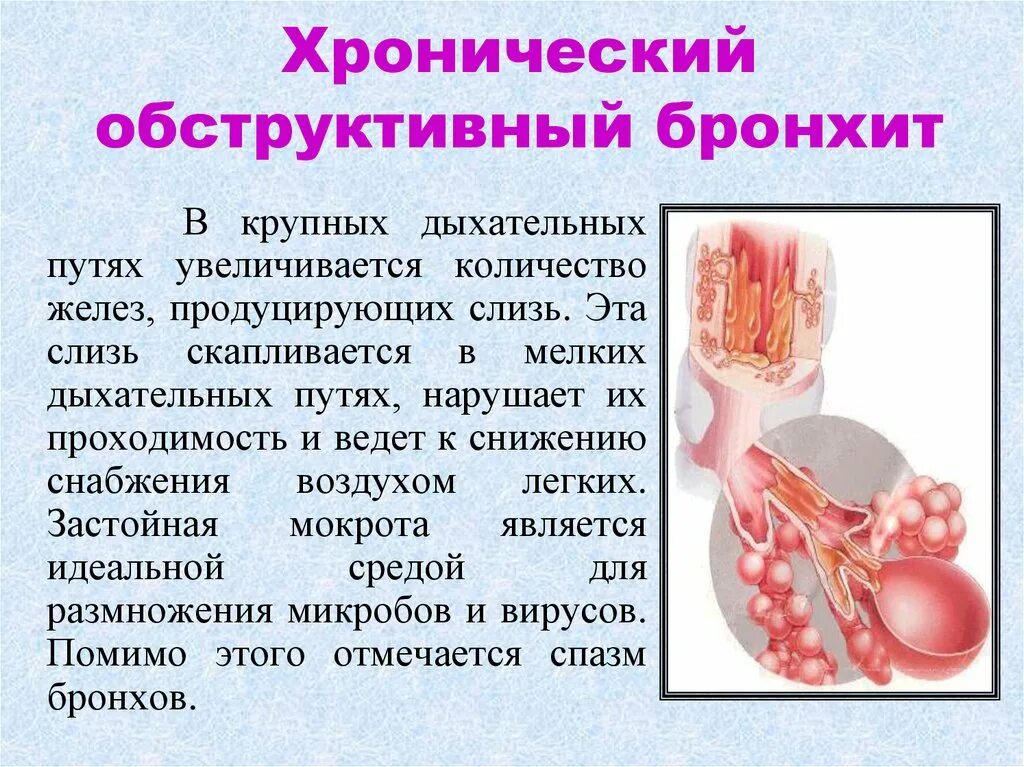 Хронический обструктивный бронхит. Хронический деструктивный бронхит. Обструктивный бронхиолтит. Хронический обструктивный бронхи
