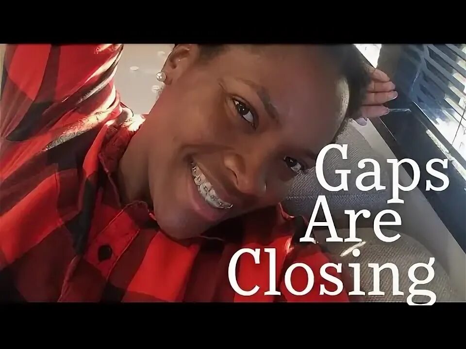 Gap closing