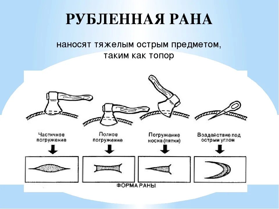 Повреждение причиненное ударом. Рубленная рана особенности. Рубленная рана презентация.