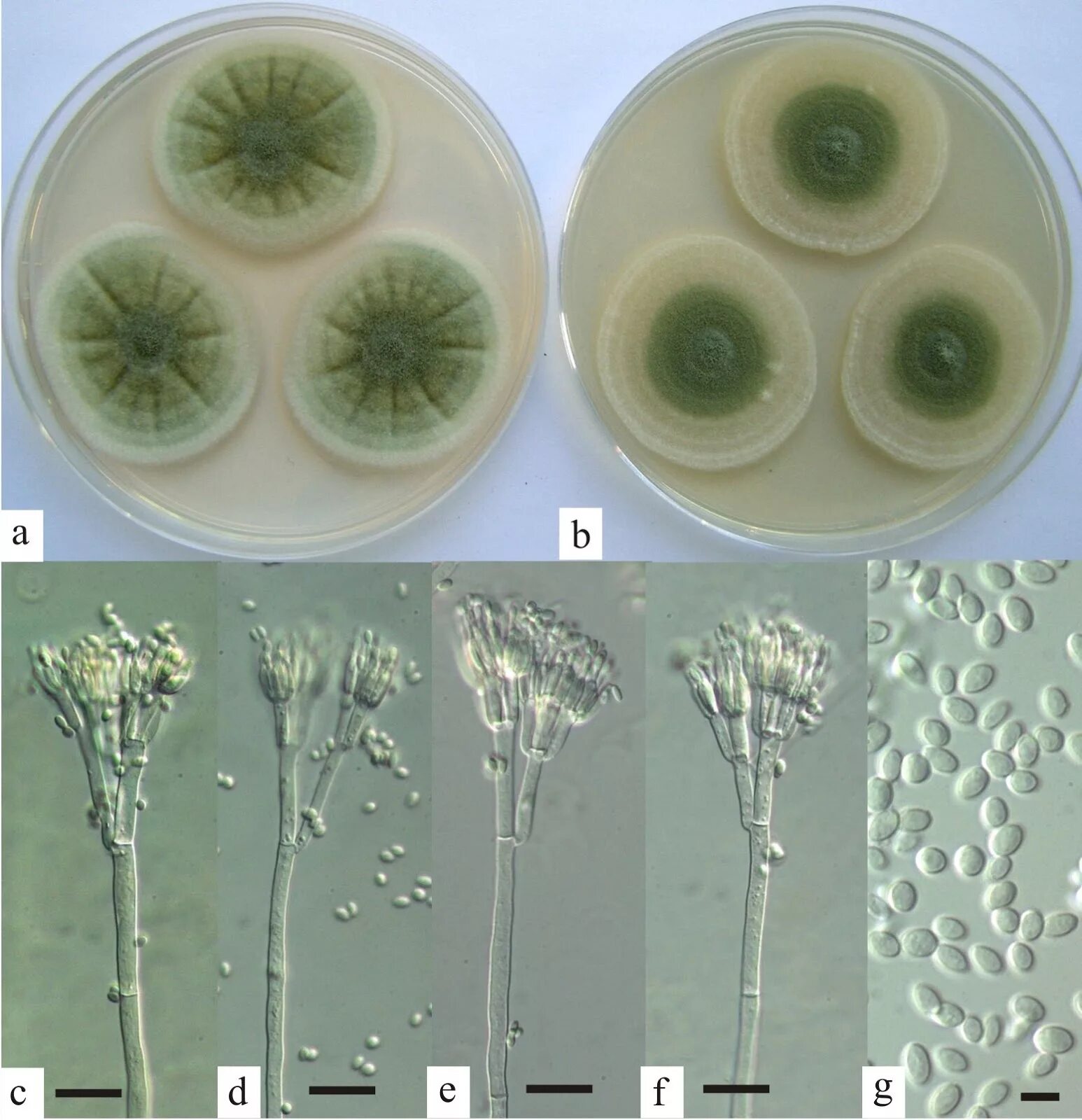 Пеницилл под микроскопом. Пеницилл и триходерма. микробиология penicillium aspergillus. пенициллин и аспергилл. грибы микроскопические penicillium.