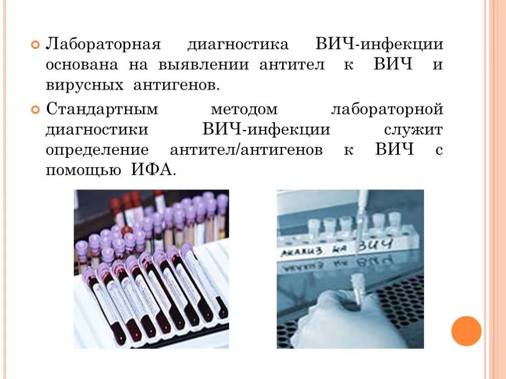 Метод лабораторной диагностики ВИЧ инфекции. Диагностика ВИЧ инфекции вирусологический метод. Метод лабораторной диагностики для обнаружения ВИЧ. Стандартный метод лабораторной диагностики ВИЧ инфекции. Диагностика вич инфекции осуществляется методом