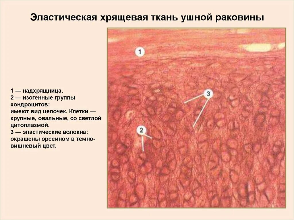 Изогенные группы. Эластический хрящ ушной раковины препарат. Эластический хрящ ушной раковины препарат гистология. Эластическая хрящевая ткань ушной раковины гистология. Эластический хрящ ушной раковины орсеин.