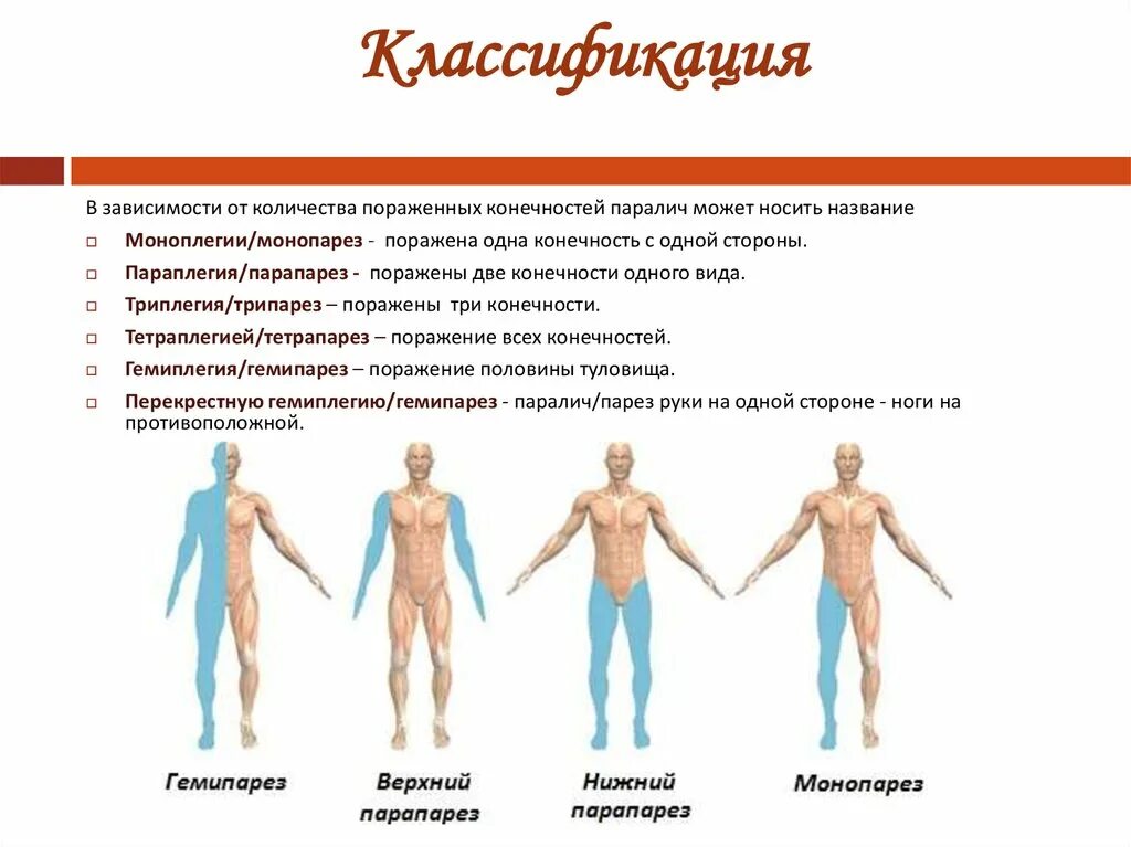 Нарушение функций 1 степени. Нижний периферический парапарез развивается при поражении. Центральные спастические параличи классификация. Левосторонний спастический гемипарез очаг поражения. Гемипарез верхний парапарез Нижний парапарез монопарез.