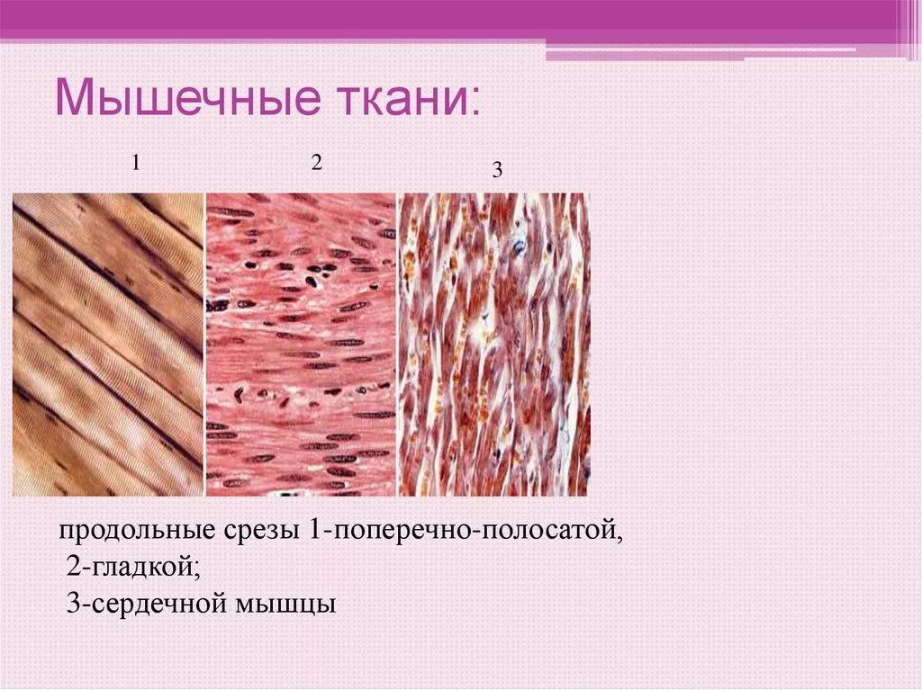 Гладкая мышечная ткань источник. Гладкая мышечная ткань микропрепарат. Строение исчерченной мышечной ткани. Мышечная ткань микропрепарат. Поперечно полосатая мышечная ткань человека под микроскопом.