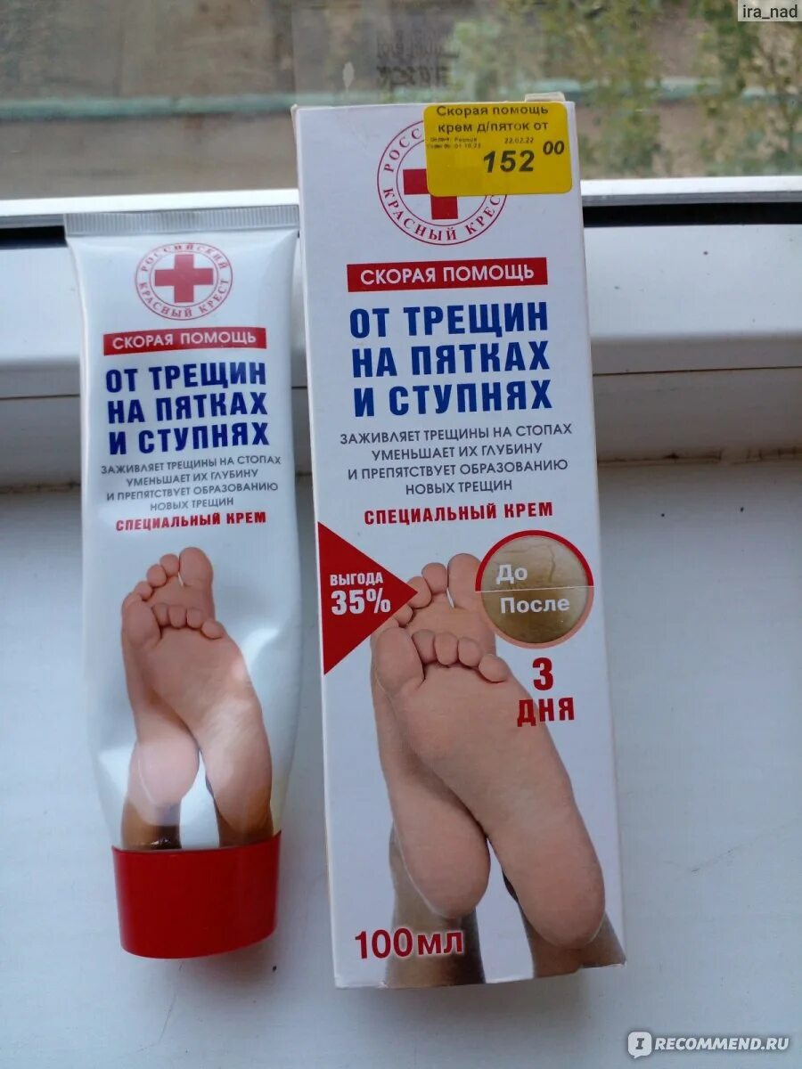 Помощь от трещин на пятках. Специальный крем от трещин на пятках. крем от трещин на пятках с заживляющим эффектом.