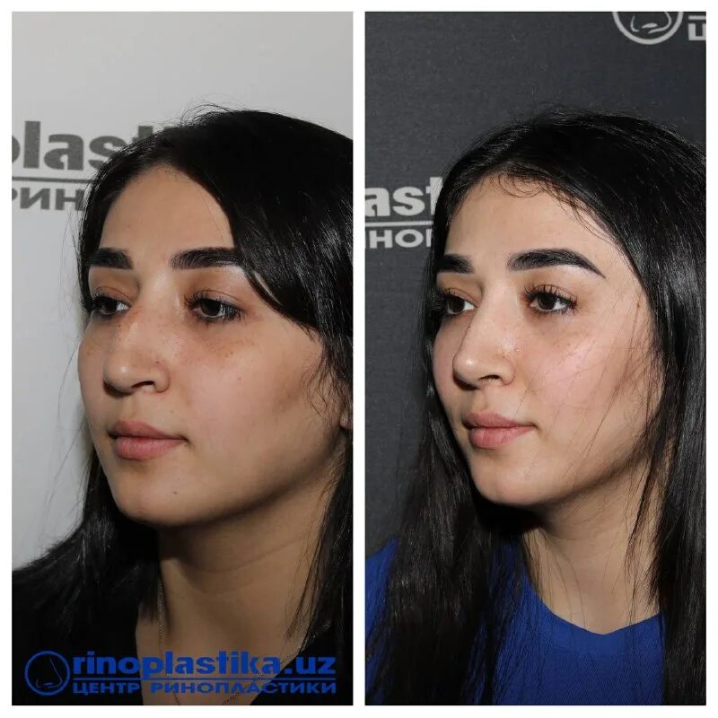 центр ринопластики