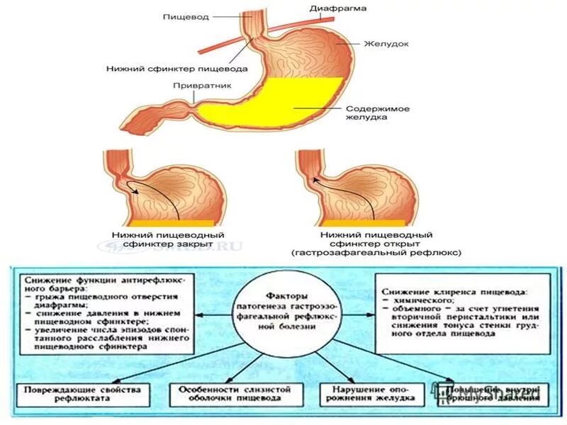 бананы при гэрб