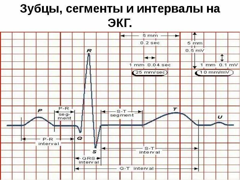 Зубцы и сегменты ЭКГ норма. Зубцы интервалы и сегменты ЭКГ норма. ЭКГ норма величины зубцов. Нормы зубцов и интервалов ЭКГ. Зубцы экг в норме