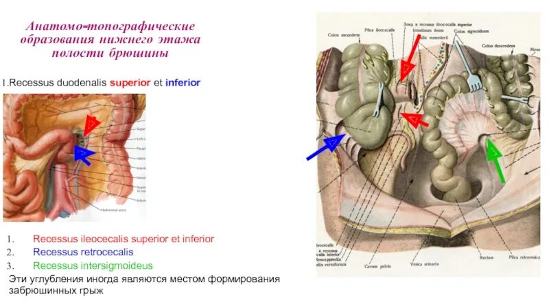 Межсигмовидный карман. Межсигмовидное углубление. Карманы нижнего этажа брюшной полости топографическая анатомия. Межсигмовидное углубление. Карманы брюшины топографическая анатомия.