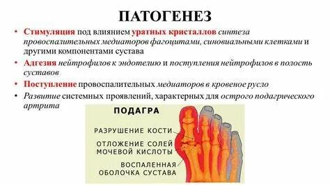 Подагра клинические рекомендации