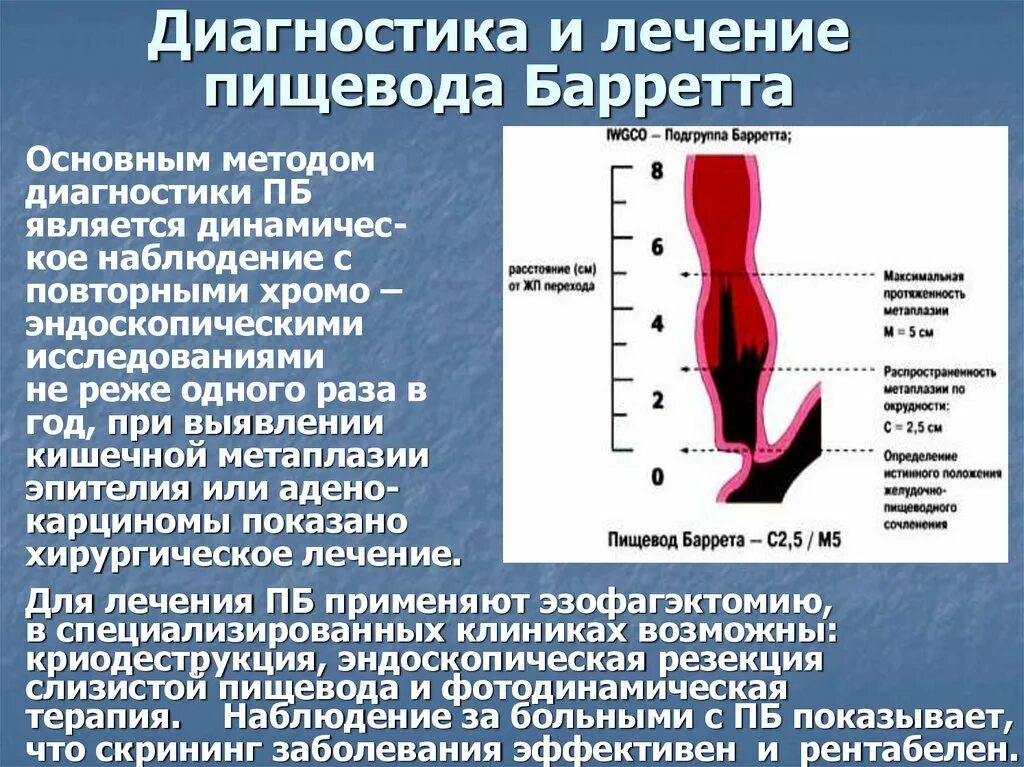 Пищевод баретта