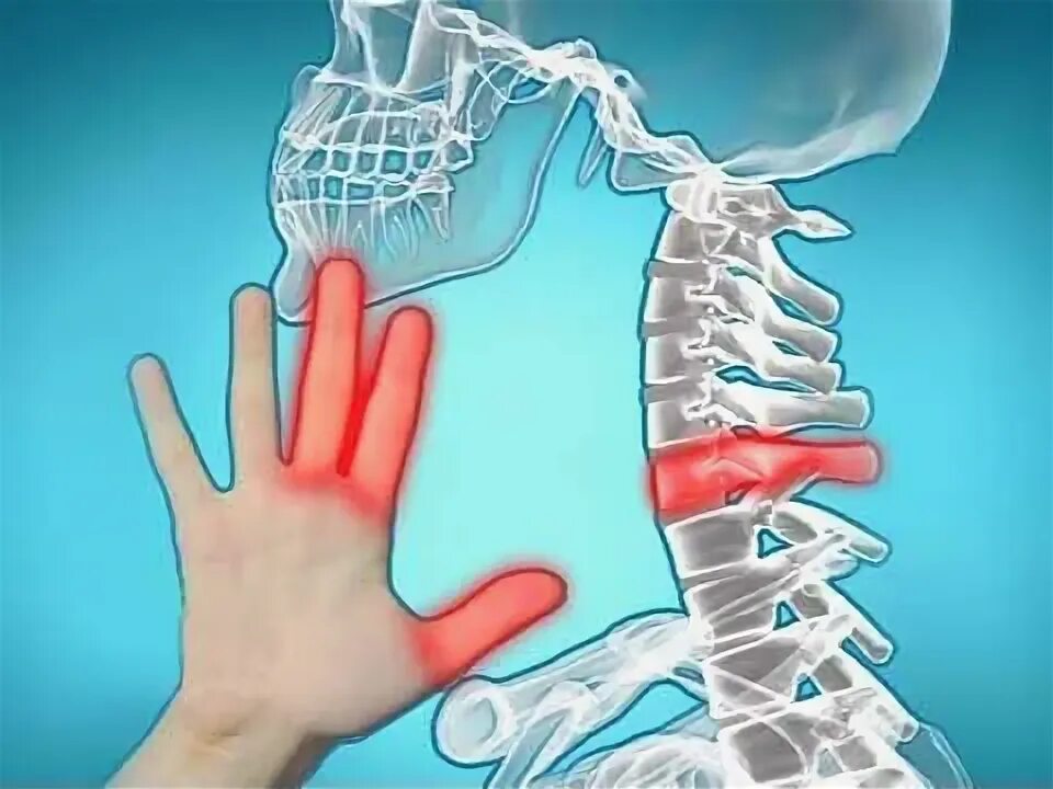 Немеют три пальца. Онемение пальцев левой руки мизинец. Онемели три пальца на левой руке. Онемение пальцев рук при остеохондрозе.
