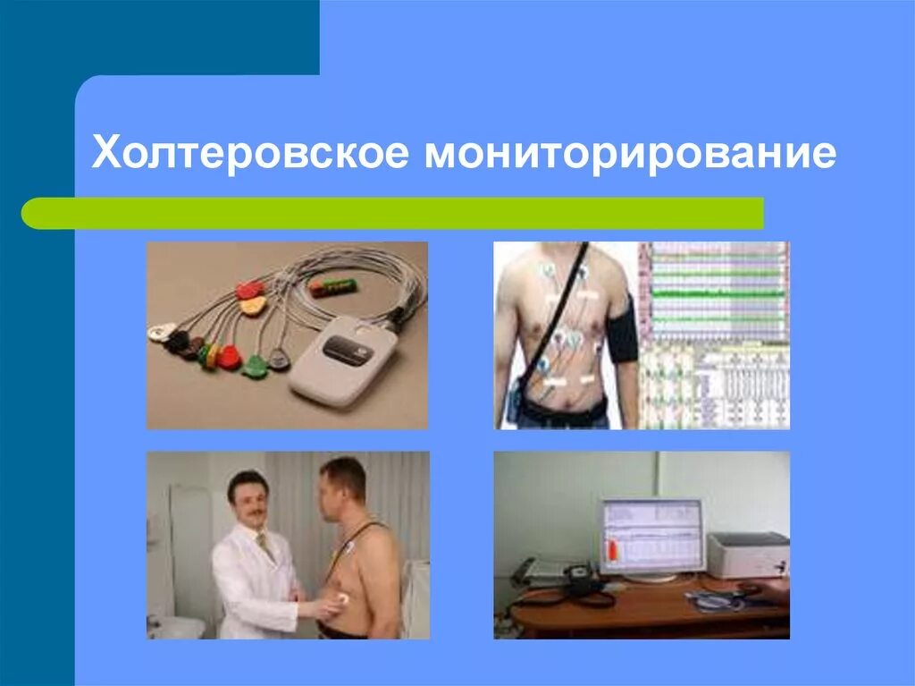 Сколько дней холтер. Холтеровское мониторирование методика наложения электродов. суточное мониторирование экг (холтер). холтеровское мониторирование установка электродов. суточное мониторирование экг по холтеру схема.