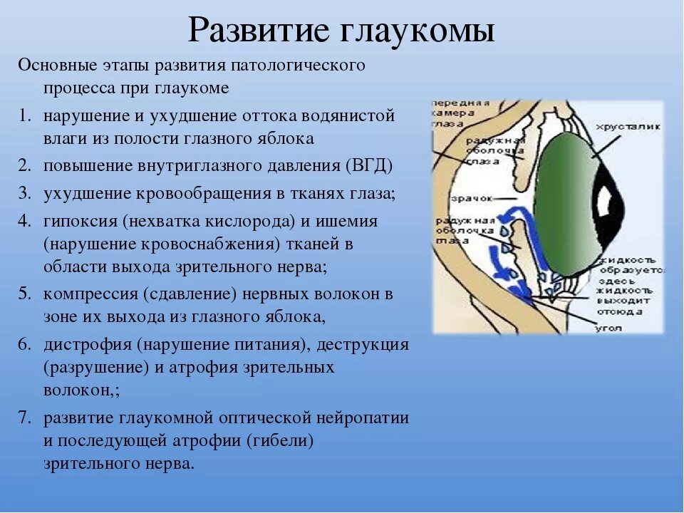 Признаки развития глаукомы