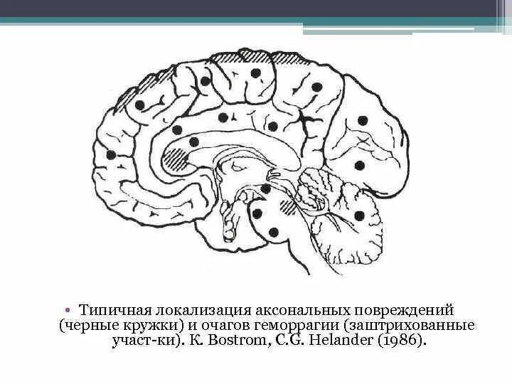 Локализация 13