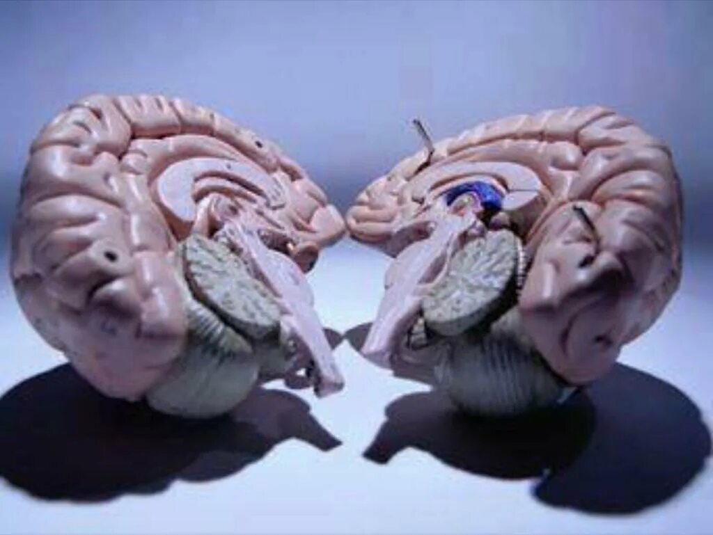 Split brain. Синдром расщепленного мозга. Модель расщепленного мозга. Мозг раздельный.