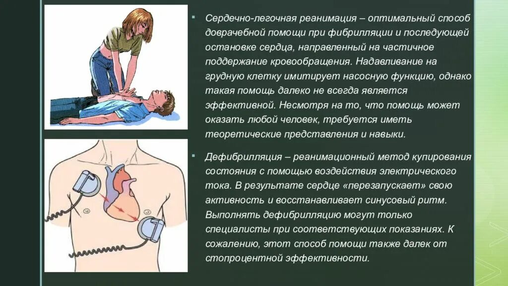 К первому этапу реанимации относится. Сердечно-лёгочная реанимация. Реанимация при остановке сердца. СЛР при остановке сердца. Оказание сердечно легочной реанимации.