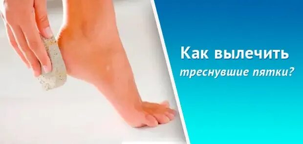Как можно вылечить пятки