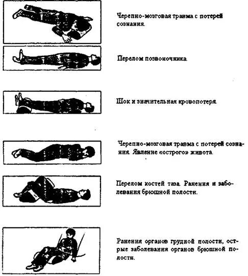 Тест на травмы первый. Транспортное положение пострадавшего с травмой. Транспортировка пострадавших при различных повреждениях. Положения тела при разных травмах. Транспортировка больных при различных повреждениях.