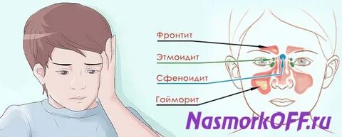 Фронтит у детей симптомы