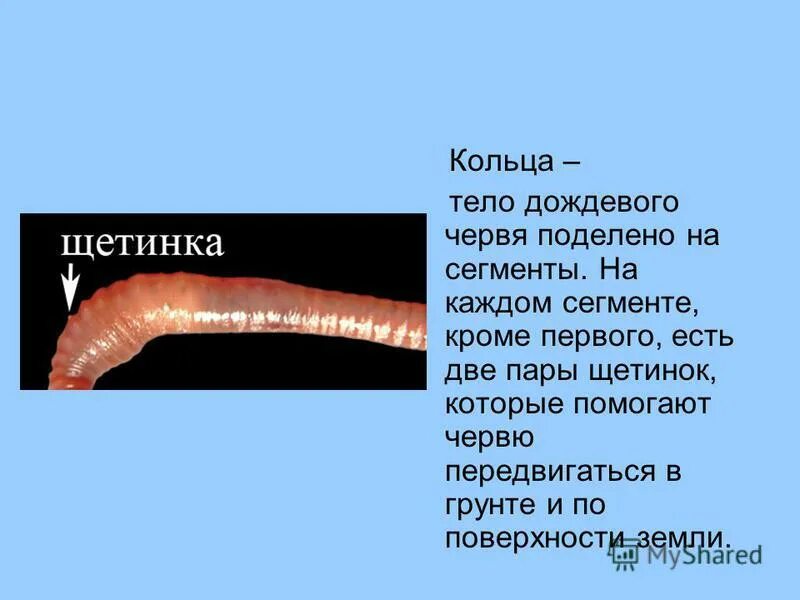 Малощетинковые дождевой червь. Наружное строение дождевого червя. Дождевой червь строение щетинки. Кольчатые черви щетинки. Замечательная особенность этого червя состоит в том