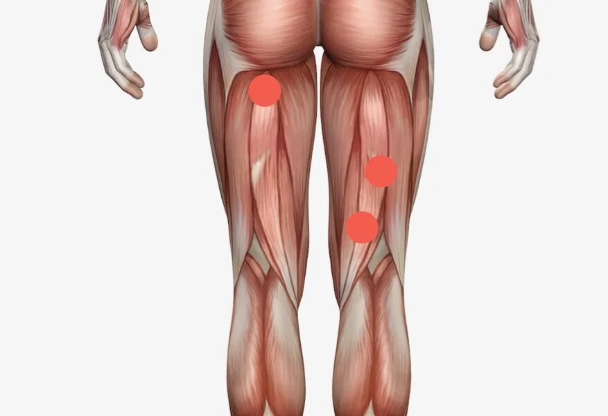 Растяжение бедренной мышцы бинтование. Полусухожильная мышца иннервация. Вывихи бедра классификация травматология. Сухожилия semitendinosus. Мышцы бедра задняя группа полусухожильная мышца.