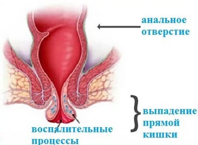 Волочкова ответила на критику свадьбы дочери KP.RU:Комсомольская правда Дзен