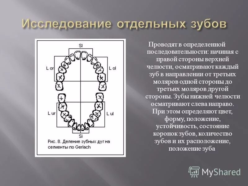 Признаки стороны зуба. Стороны зубов. Деление зубов. Апроксимальных поверхностей зубов. Определение сторон зуба.