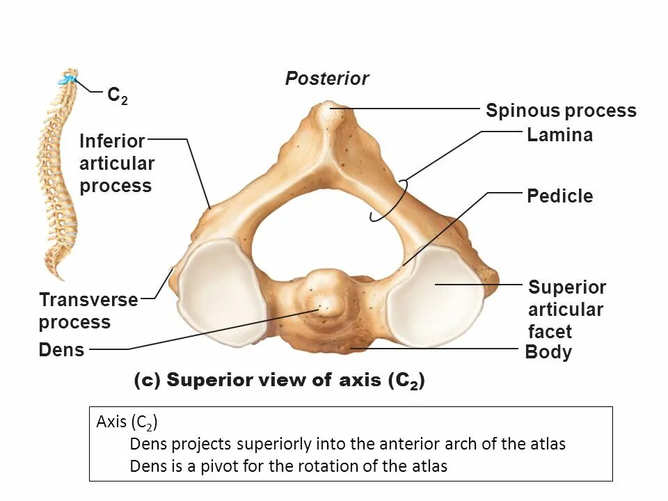 Axis c. Супериор постериор. superior articular process. dens axis. axis223007c.