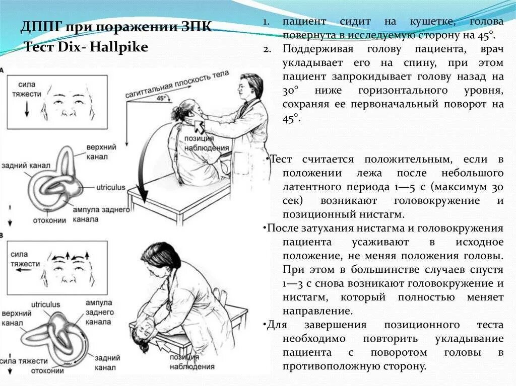 Дппг что это за болезнь. Позиционное головокружение клинические рекомендации. Позиционные маневры Эпли Семонта. Доброкачественное пароксизмальное позиционное головокружение. Ролл тест ДППГ.