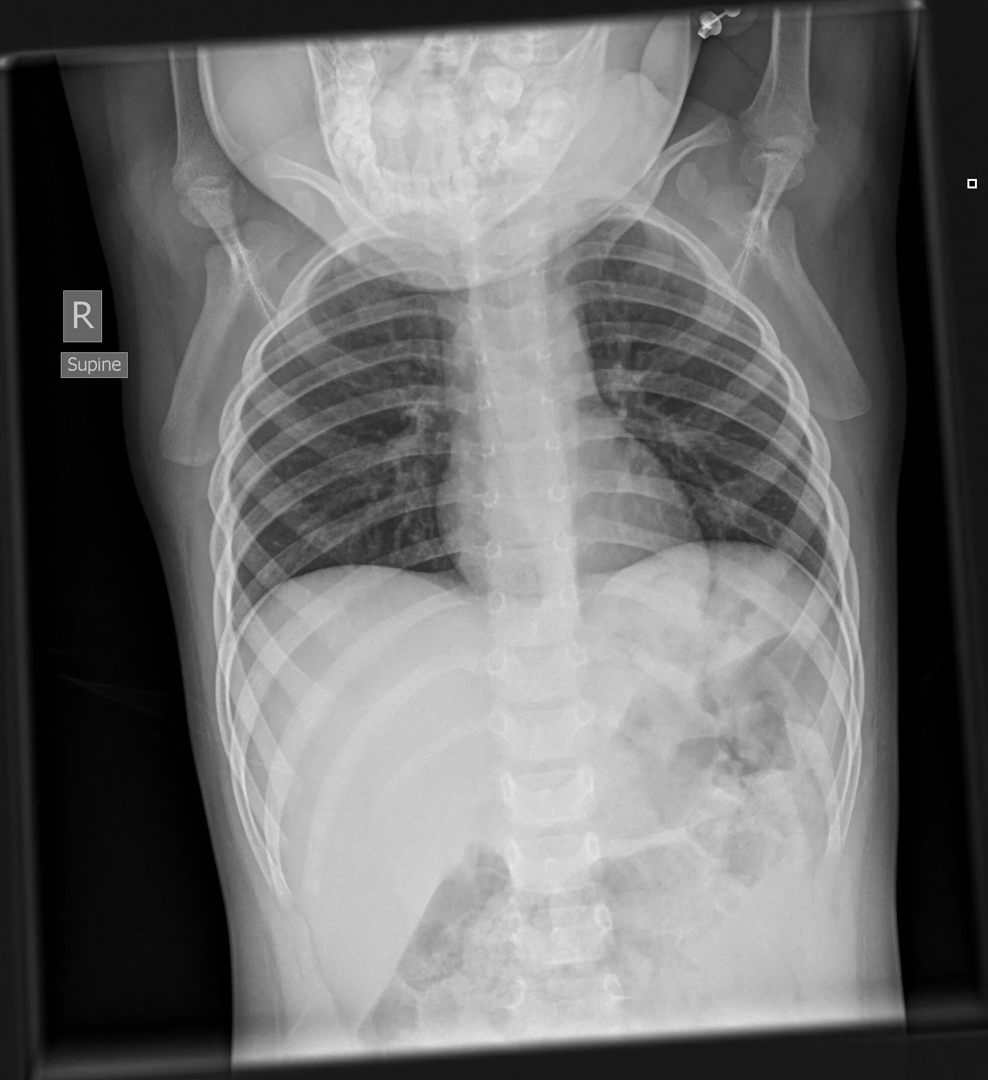 лада xray 2020. спонсоры кинетического хрэй сканера. рентген снимки. лада икс рей 2022. журналы цветы арт.