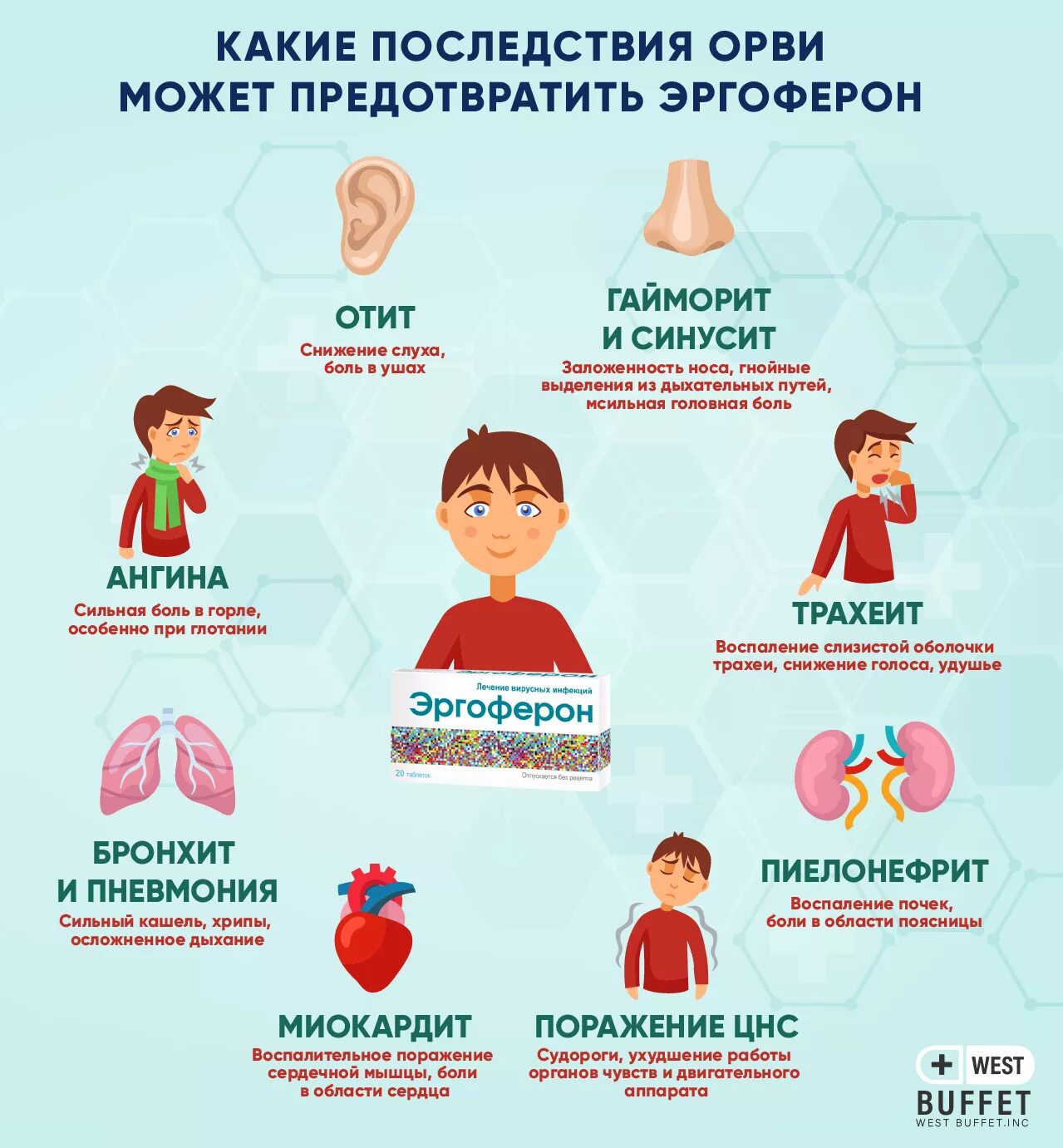 Что делать если часто болеешь простудными заболеваниями. Симптомы острой респираторной вирусной инфекции у детей.. Симптоматика ОРВИ. Осложнения гриппа у детей. Симптомы ОРВИ У детей.