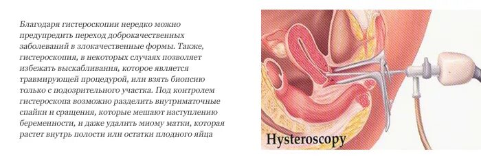 Гистероскопия матки день цикла. Матка после гистероскопии. на какой день цикла делают гистероскопию. гистероскопию на какой день цикла. гистероскопия при нарушении цикла.