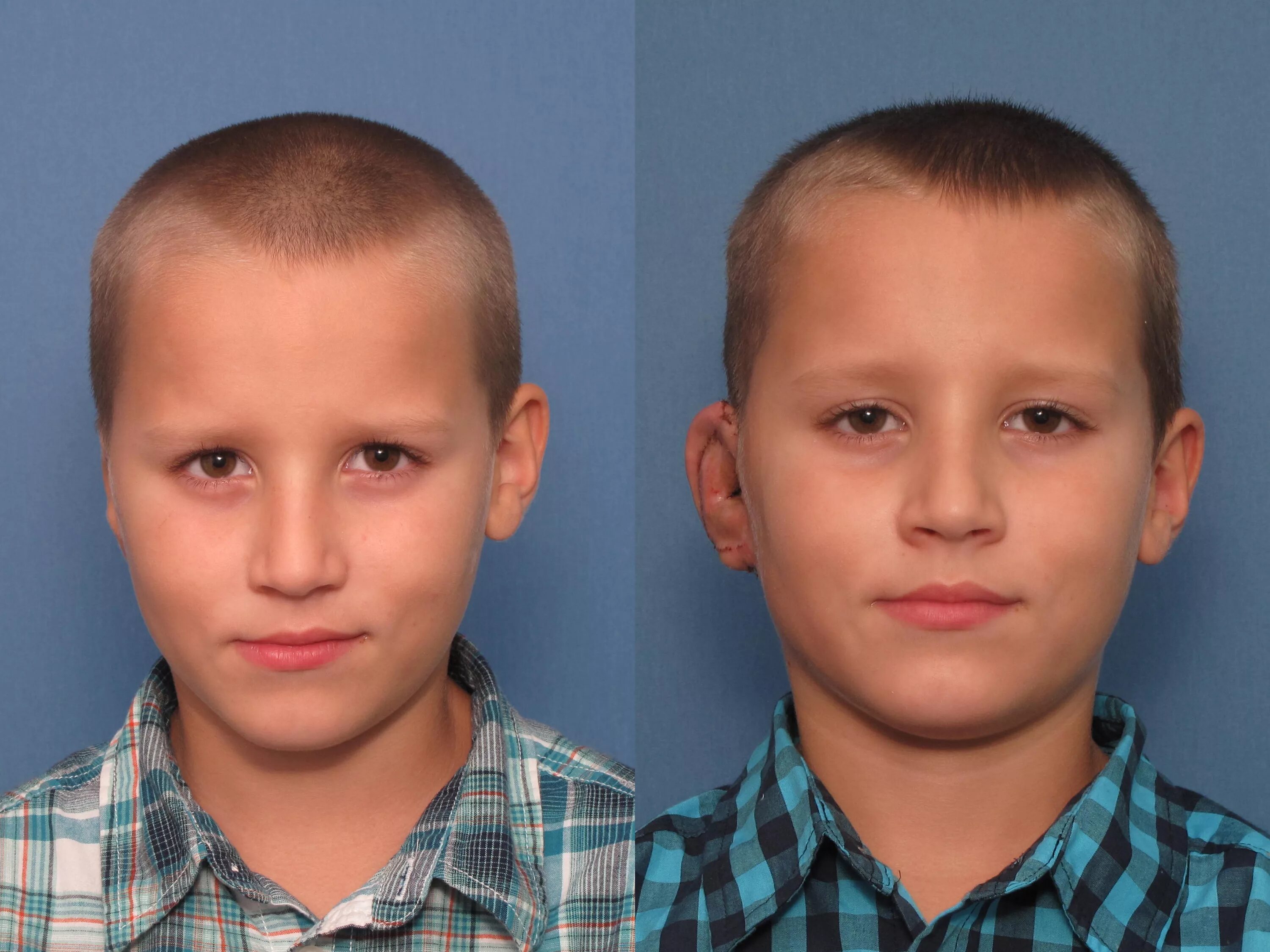 асимметрия лица у подростка. асимметрия лица. исправление асимметрии лица. асимметрия лица у подростка. асимметрия лица у подростка.