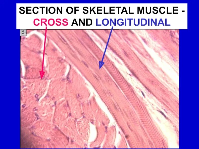 Поперечнополосатая мышечная ткань гистология. Поперечно Скелетная мышечная ткань. Скелетная мышечная ткань микропрепарат. Скелетная поперечно-полосатая мышечная ткань продольный срез. Препарат поперечно полосатая мышечная ткань