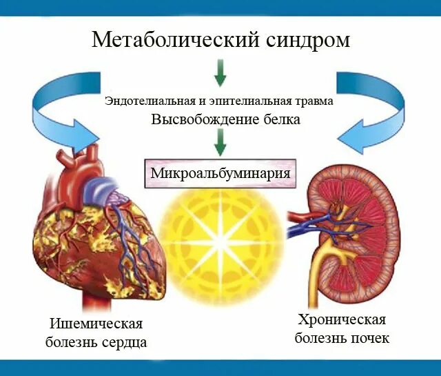 Повышенный альбумин в моче. Норма микроальбуминурии. Микроальбумин мочи. Микроальбумин в моче что это такое. Микроальбумин при сахарном диабете.