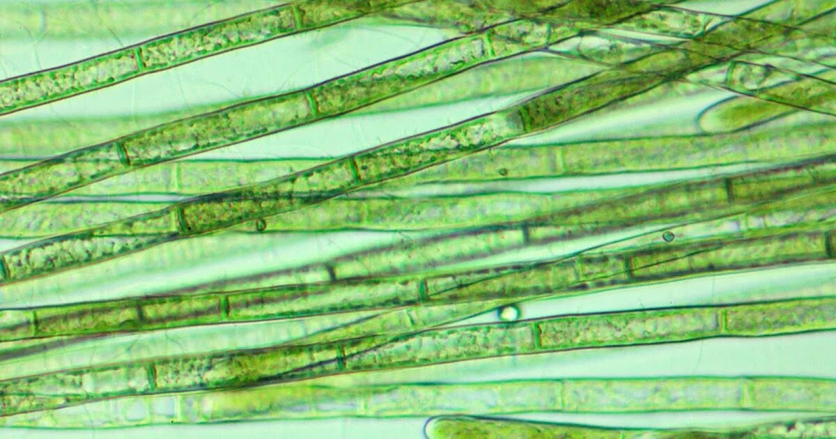 Спирогира красная. Нитчатые водоросли микроскоп. Нитчатые цианобактерии. Микроскопические нитчатые зеленые водоросли. Цианобактерии бациллы.
