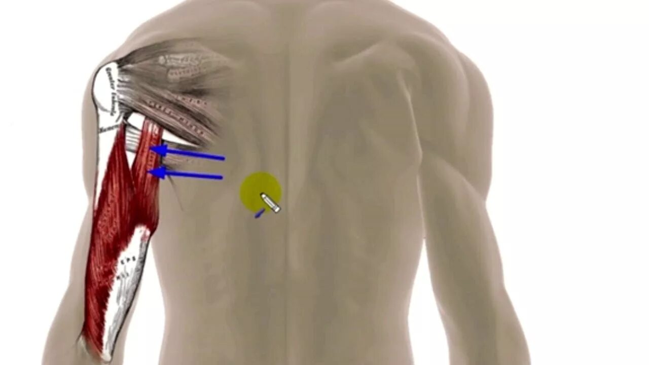 Латеральная головка трицепса. Болит трицепс. Как качать грудные мышцы в домашних условиях. Растяжение плечевой мышцы. Сухожилия головки двуглавой мышцы плеча.