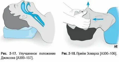 Улучшить положение