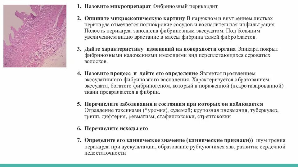 Фибринозный перикардит. Окраска гематоксилином и эозином.. Фибринозный перикардит макропрепарат. Фибринозный перикардит микропрепарат. Фиброзный перикардит гистология.