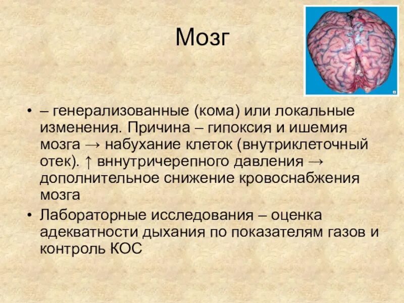 Отек мозга что это такое. Ишемия кислородное голодание мозга.