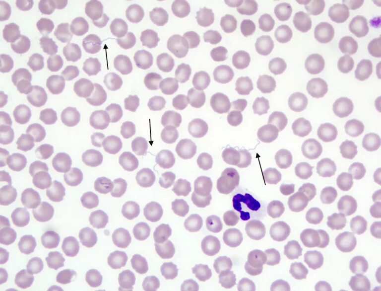 Borrelia recurrentis микробиология. Боррелиоз микроскопия по романовскому гимзе. Окраска по романовскому гимза риккетсии микробиология. Боррелия по романовскому гимзе. Боррелии реккурентис.