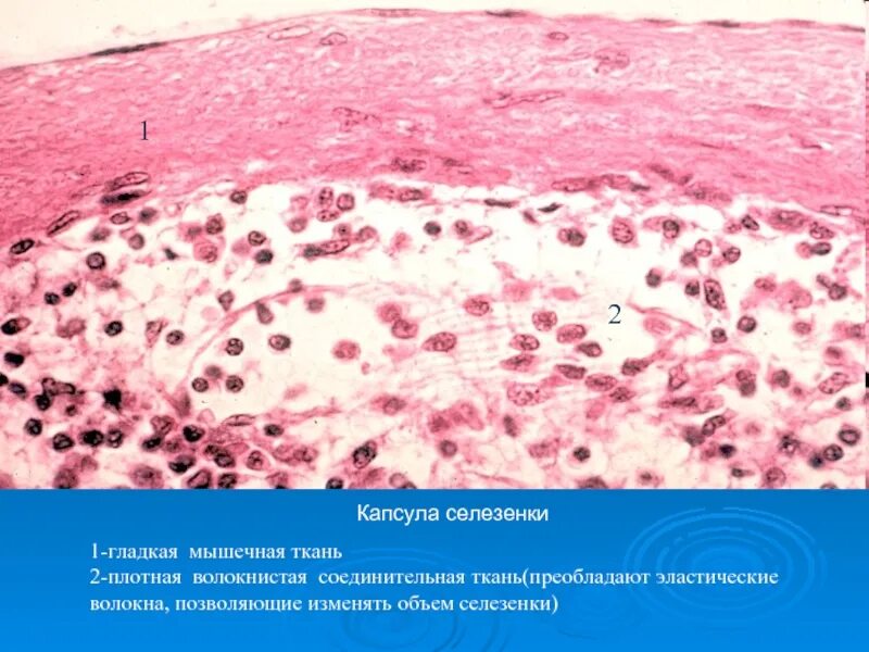 Ткань капсулы селезёнки. Соединительнотканная капсула селезенки. Гиалиноз капсулы селезенки. Гиалинизированная соединительная ткань. Стволовые клетки селезенки
