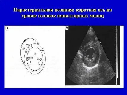 Короткая ось