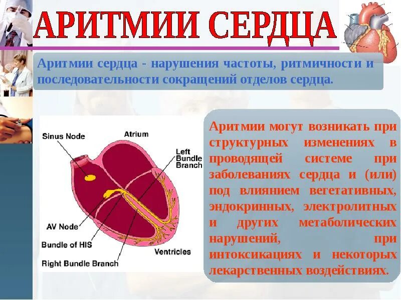 Аритмия и гипертония. Аритмия сердца. Профилактика аритмии сердца. Аритмия памятка. Сердечные аритмии.