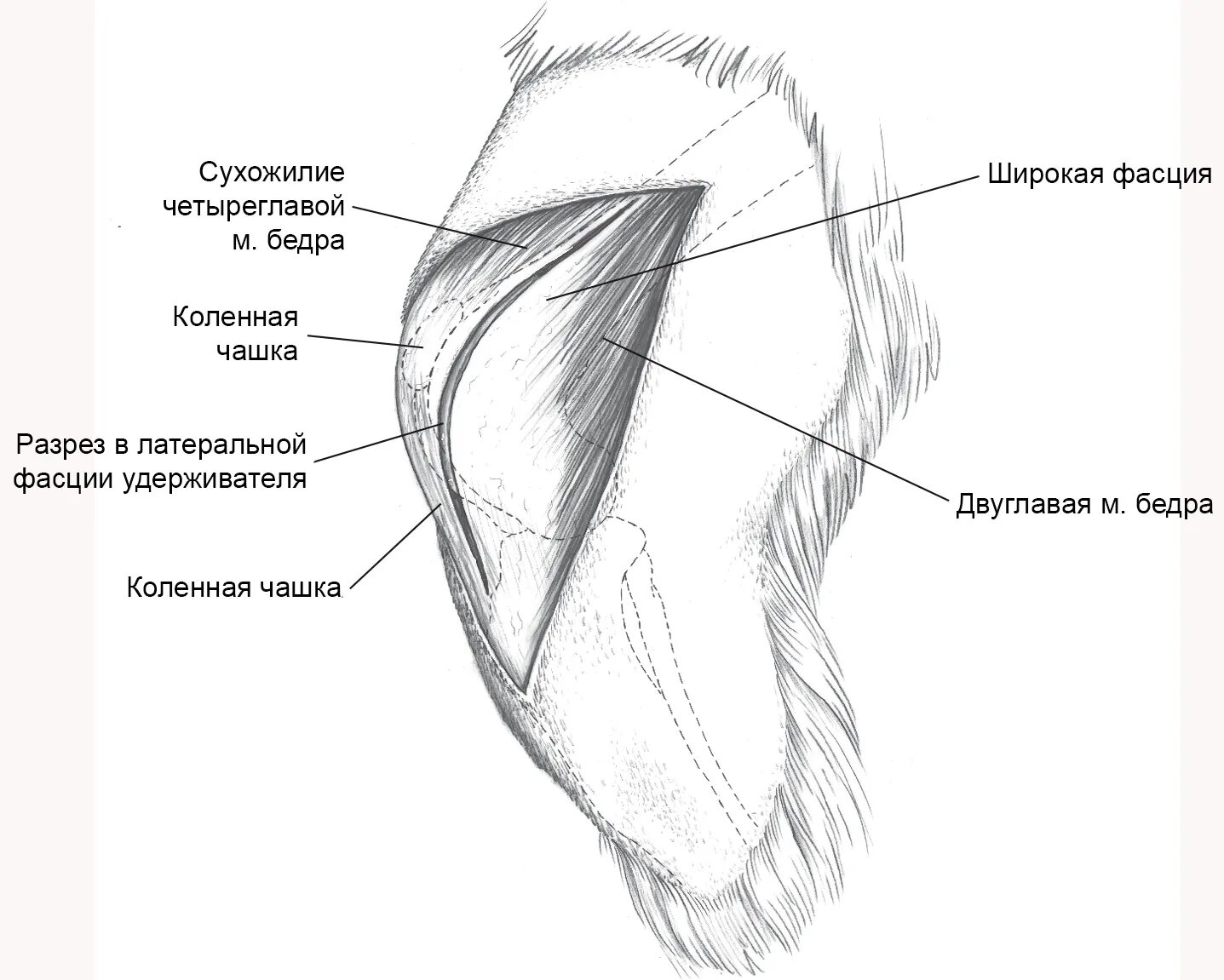 Собственная фасция бедра. Серповидный край фасции бедра. Верхний Рог серповидного края широкой фасции бедра. Поверхностная пластинка широкой фасции бедра. Подкожная фасция бедра.