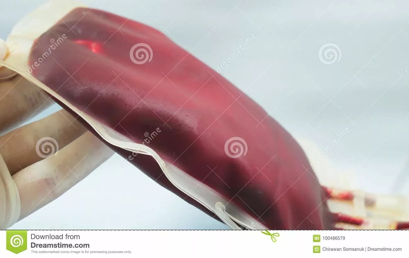 Артериальная кровь и венозная кровь. Гомморой. Кровяной мешочек. Венозная и артериальная кровь цвет. Кровяной мешочек.