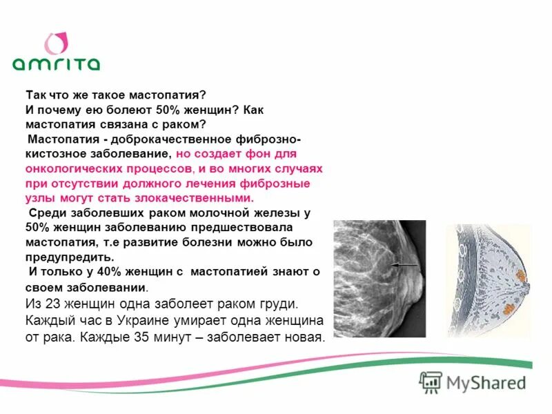 Мазь для грудных желез. Как вылечить мастопатию навсегда. Медикаментозная терапия мастопатии. Как вылечить мастопатию навсегда. Лекарства при мастопатии.