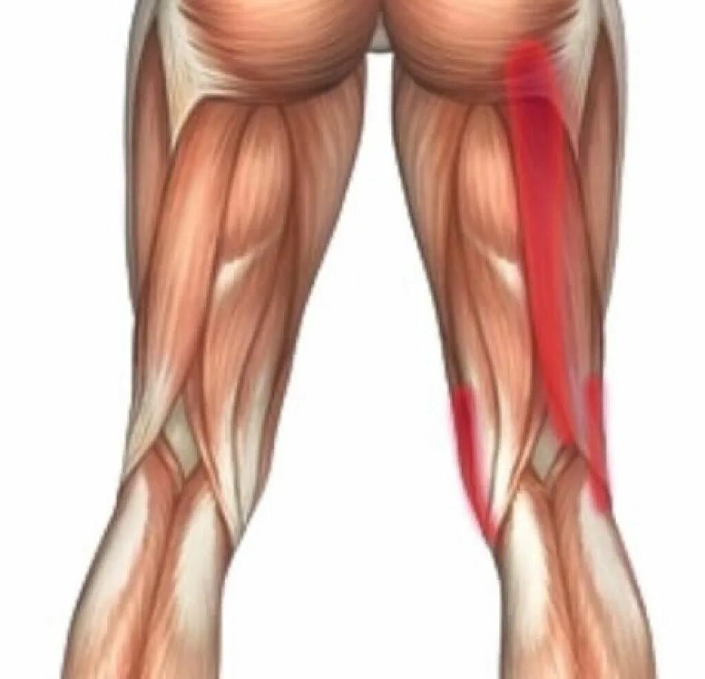 Сухожилие бедро задняя. Тендинопатия сухожилия мышцы. Тендинопатия сухожилия средней ягодичной мышцы. Тендинопатия сухожилия четырехглавой мышцы бедра.