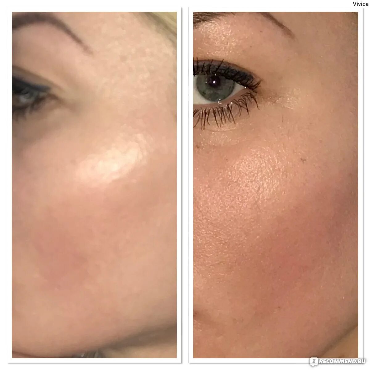 Коралловый пилинг роз де мер. Пилинг для лица. Пилинг роз. Пилинг роз. Коралловый пилинг роз де мер.